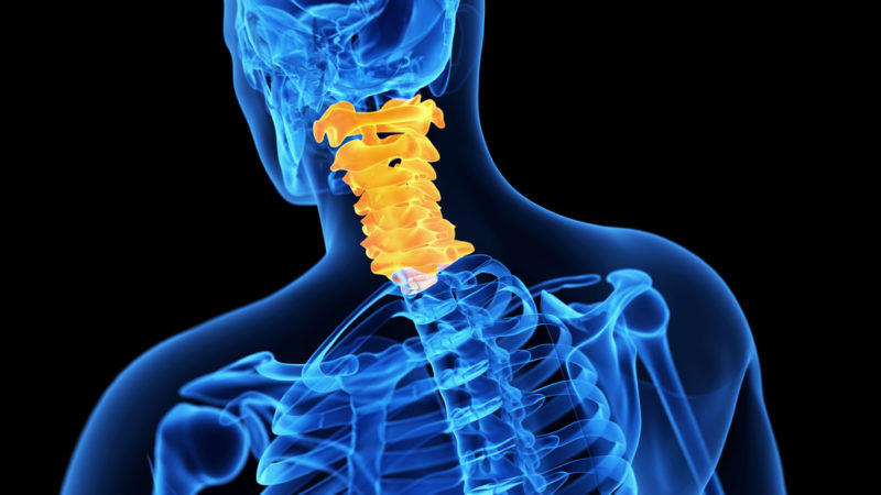 minimally invasive cervical spine