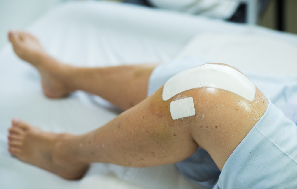 steps total knee replacement