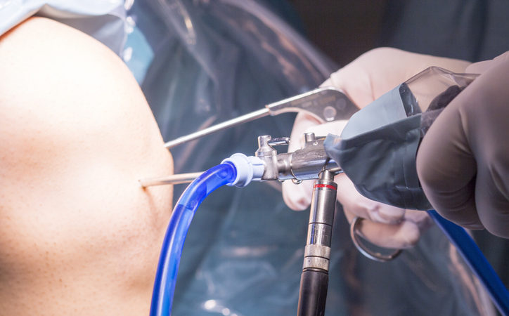 What is arthroscopy