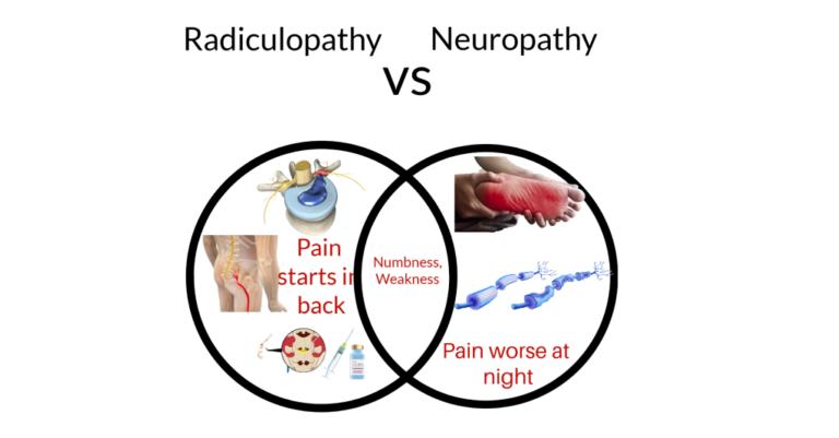 Radiculopathy Vs Neuropathy Best Practice Health Tv